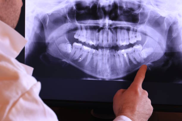 Best Emergency Denture Repair in Waynesburg, OH