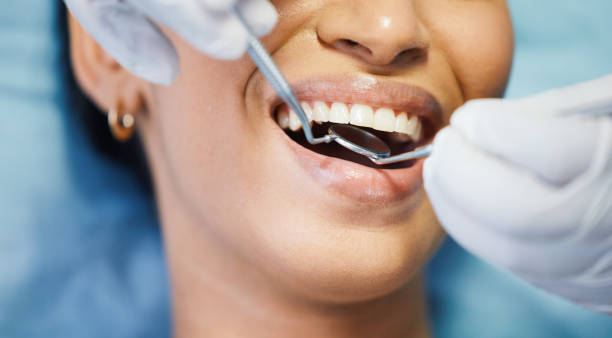Best Emergency Dental Care for Broken or Chipped Teeth in Waynesburg, OH