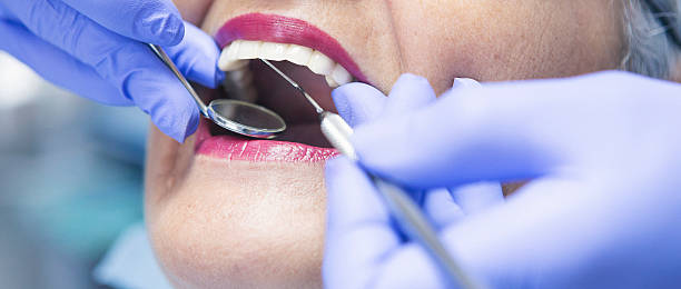 Best Emergency Tooth Extraction in Waynesburg, OH